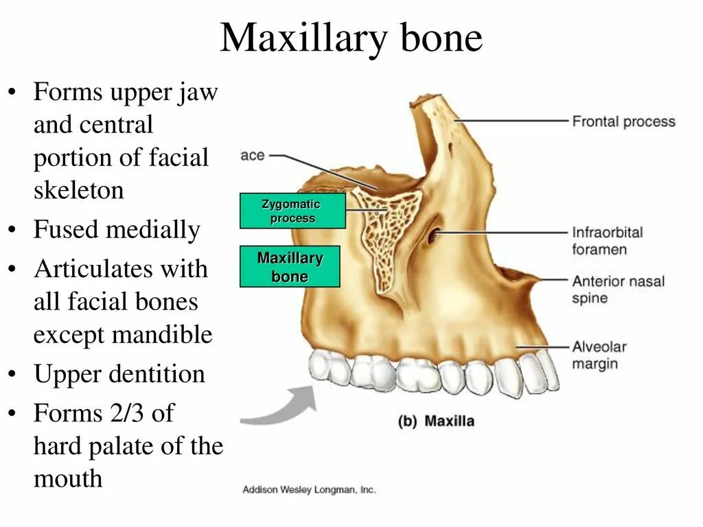 Maxillary Bone. Tuber Maxillae челюсть. Maxillary process. Zygomatic process of the Maxilla. The bones form