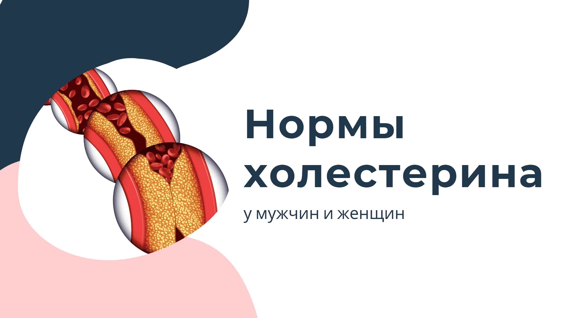 Тест холестерин норма. Холестерин норма. Холестерин у мужчин. Холестерин норма у мужчин. Холестерин норма у женщин.