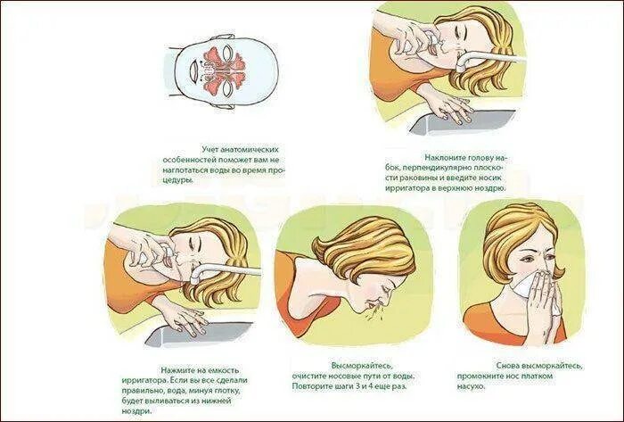 Как правильно промыть нос шприцом взрослому. Как правильно промывать нос раствором с шприцом. Как правильно промывать нос солевым раствором из спринцовки. Как промыть нос солевым раствором из шприца ребенку. Как правильно промывать нос солевым раствором из шприца в домашних.