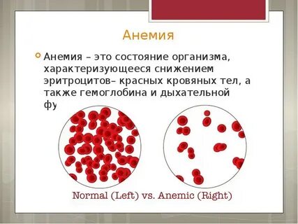 Анемия пятна