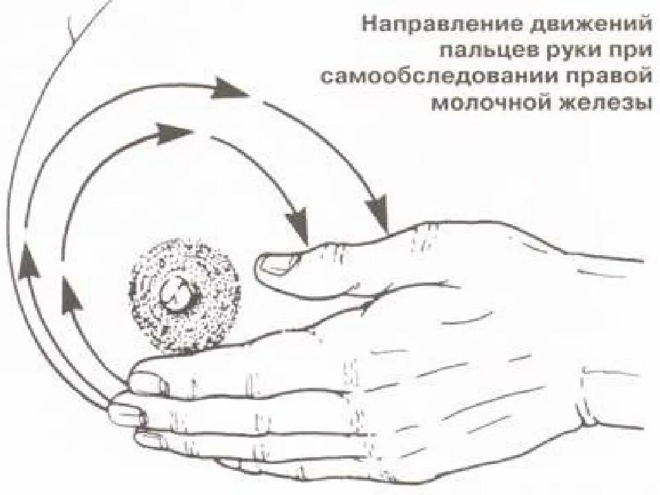 Пальпация молочных желез схема. Исследование молочных желез пальпация. Техника пальпации молочных желёз. Пальпация при самообследовании молочных желез. Нажать на сосок