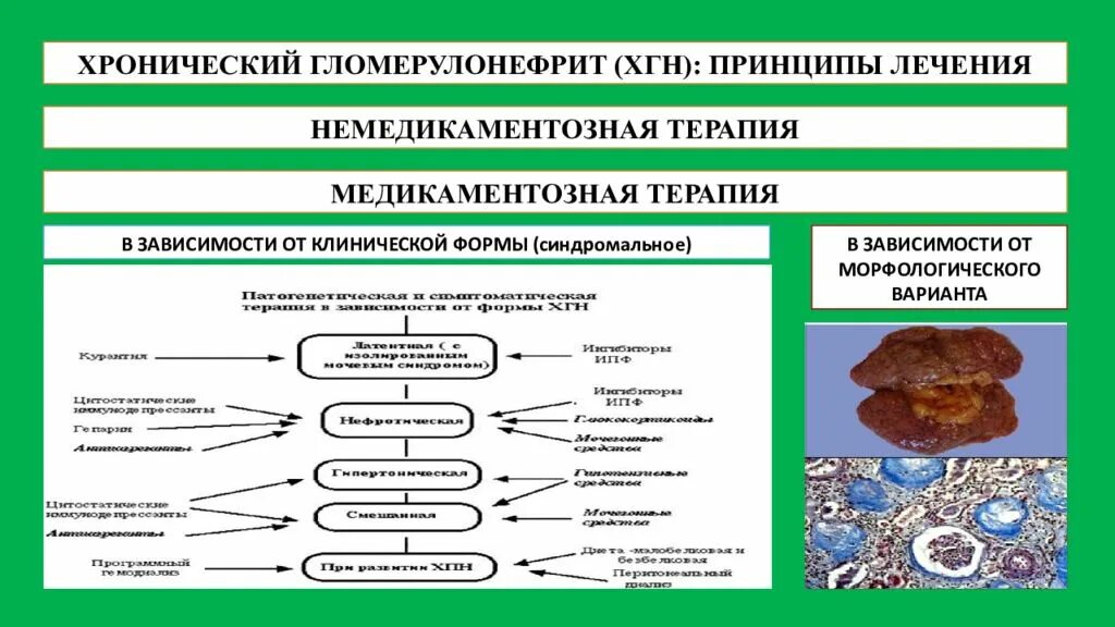 Принципы терапии хронического гломерулонефрита. Хронический гломерулонефрит схема терапии. Патогенез хронического гломерулонефрита. Механизм развития гломерулонефрита.