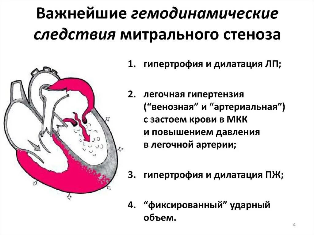 Митральный стеноз признаки. Гемодинамика при митральном стенозе схема. Приобретенные пороки сердца схема. Митральная недостаточность гемодинамика схема. Аортальная недостаточность гемодинамика схема.