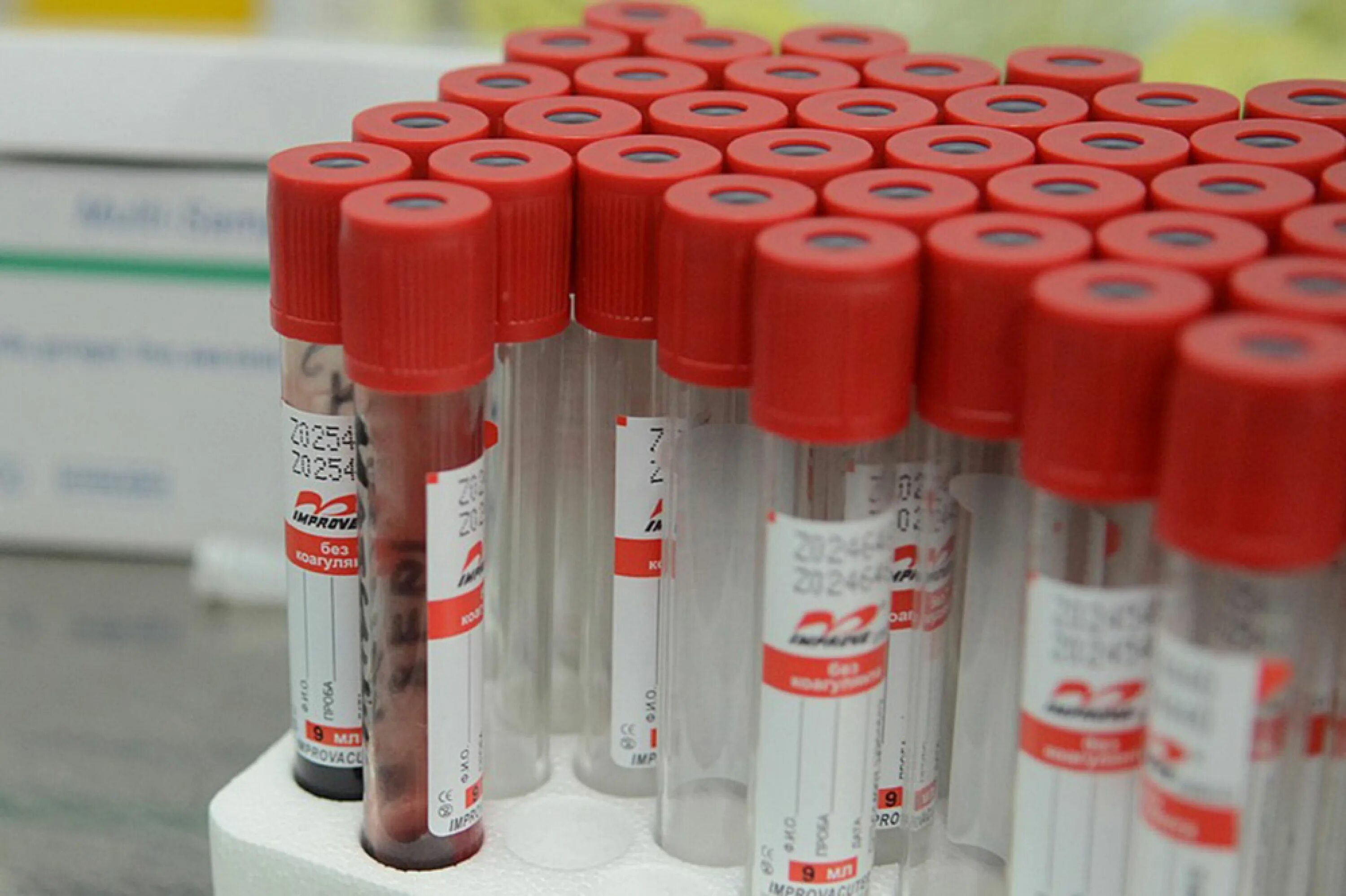 Вакцинация от коронавируса в Липецке. Штамм фабрика крови.
