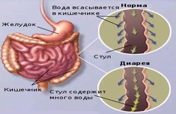 Диарея. Всасывание воды происходит в желудке