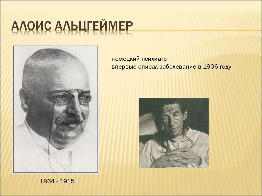 Сенильная деменция альцгеймеровского типа. Альцгеймер википедия. С немцем альцгеймера. Болезнь альцгеймера что это за болезнь. Синдром альцгеймера.