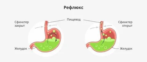 Чем нейтрализовать желчь