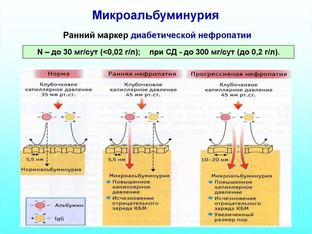 Микроальбумин в суточной моче повышен. Микроальбуминурия при диабетической нефропатии. Альбумин в моче микроальбуминурия. Микроальбуминурия при сахарном диабете норма. Норма микроальбумина в моче.