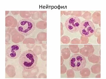 Палочкоядерные нейтрофилы