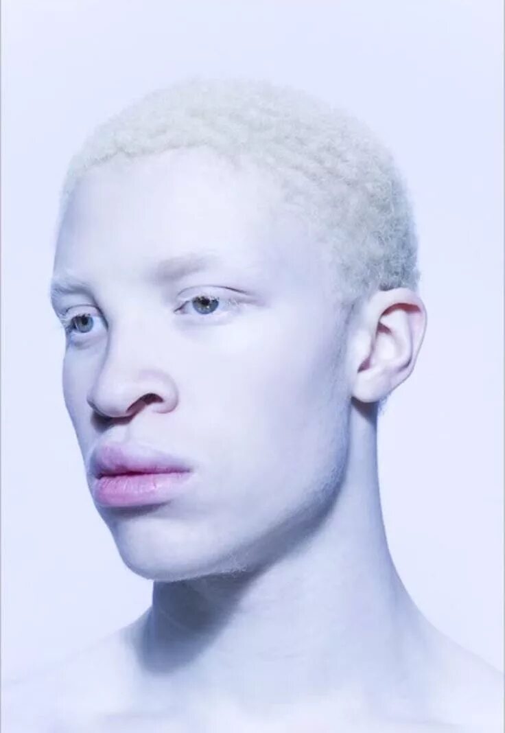Что самое белое в черных людях. Негр альбинос Шон Росс. Шон Росс модель. Шон Росс аиу. Модель альбинос Шон Росс.