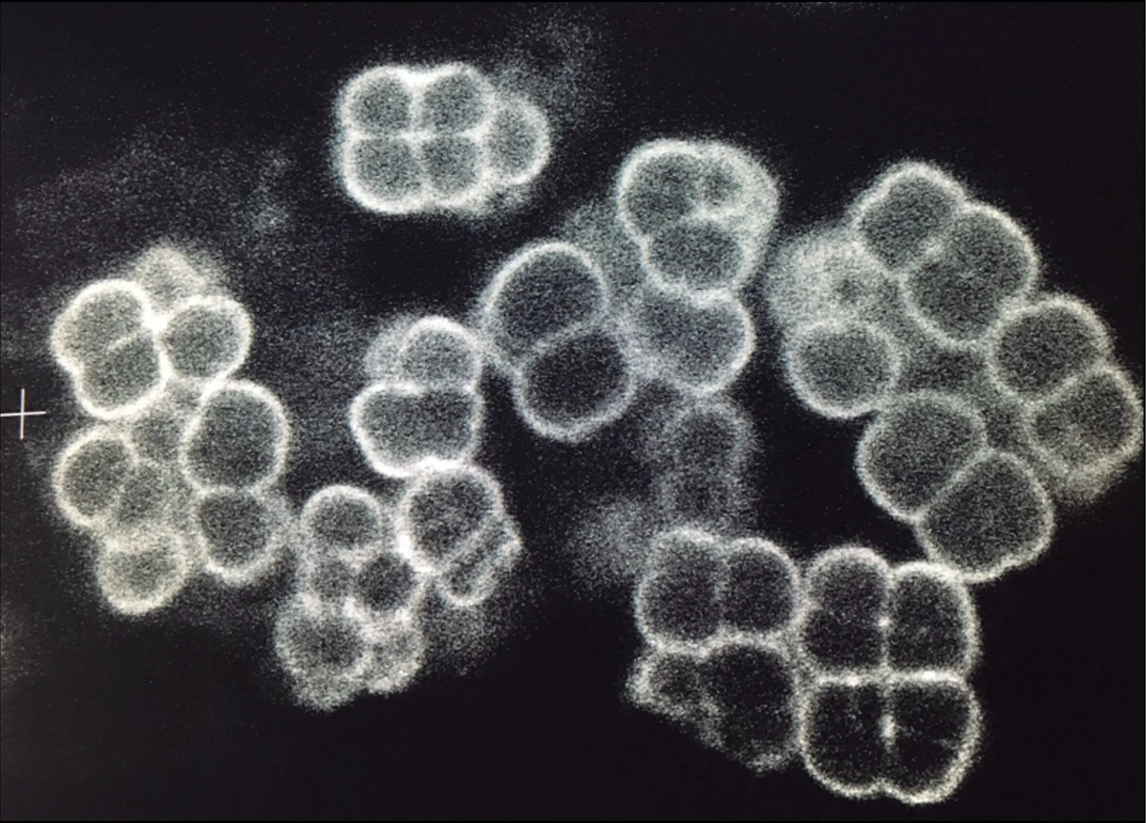 Сарцины морфология. Сарцины микробиология. Бактерии сарцины описание. Сарцины бактерии. Сарцины бактерии.
