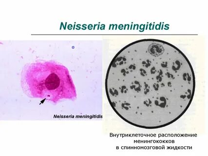 Neisseria spp