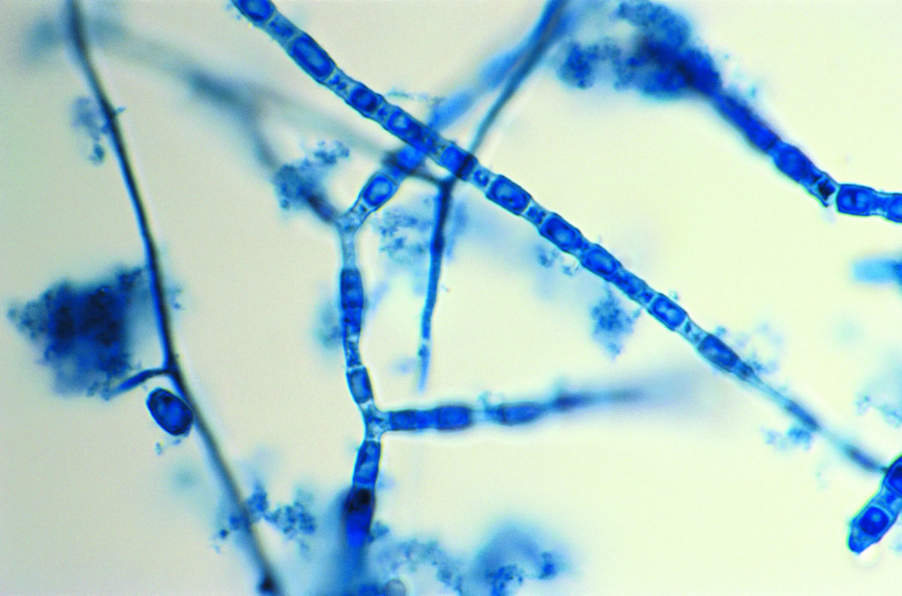 Ризопус фитопатоген. Fungi днк. Fungi structure. Fungi днк. Возбудитель пневмоцистоза микробиология.