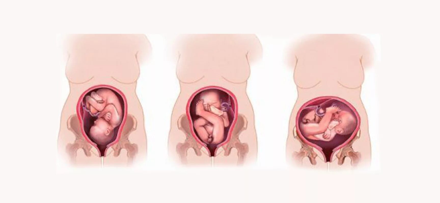 На какой недели ребенок переворачивается вниз головкой. Продольное предлежание плода при беременности 26 недель. Предлежание плода головное положение плода продольное, позиция 2. Продольное положение плода тазовое предлежание плода. Положение плода в матке, позицию, предлежание:.