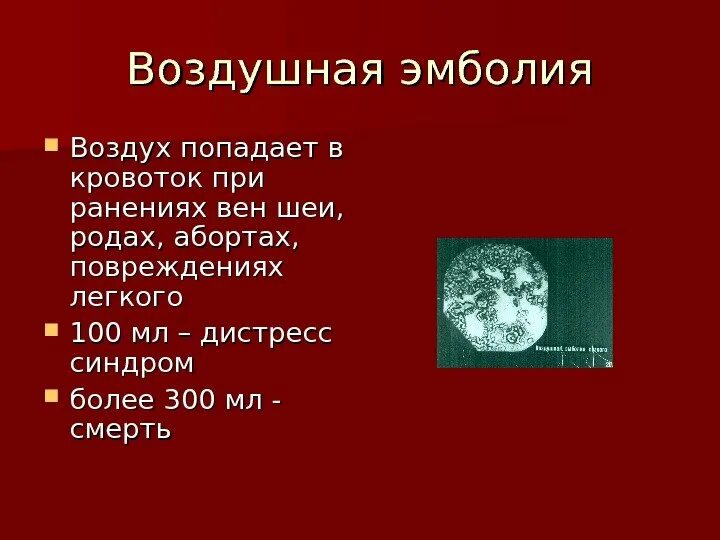 Эмболия латынь. Воздушная эмболия вен шеи. Воздушная эмболия при ранении вен. Воздушная эмболия при ранении вен шеи. Воздушная эмболия осложнения.