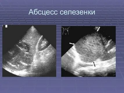 Узи селезенки делают