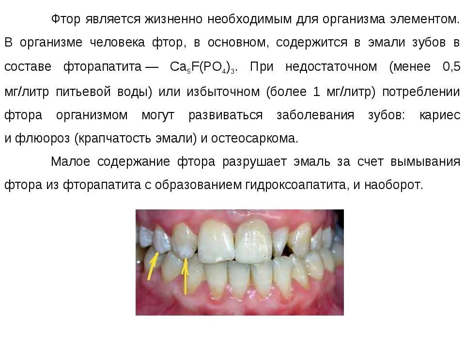 Длительный избыток фтора может привести к развитию. Избыток фтора в организме. Заболевания при избытке фтора. Роль фторидов в организме. Флюороз развивается при содержании.