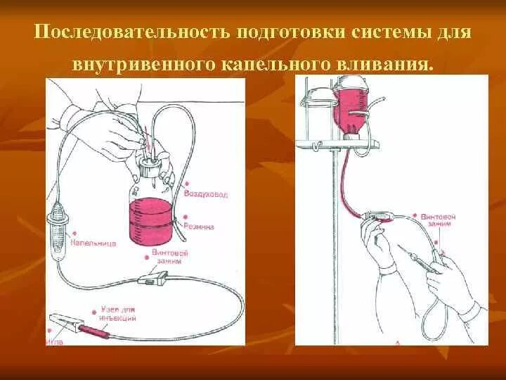 Как поставить систему