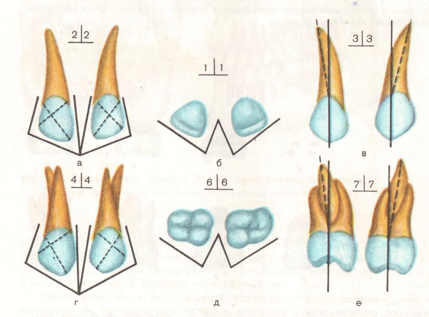 Молочный прикус анатомия зубов. Анатомия постоянных зубов. Строение молочных и постоянных зубов.