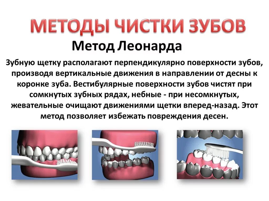 Методы чистки зубов в стоматологии презентация. Метод Леонарда чистки зубов. Плюсы чистки зубов