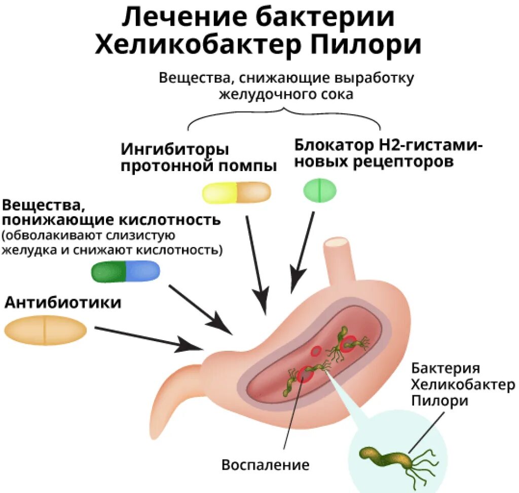 Антибиотик убивающий хеликобактер. Заражение хеликобактер пилори симптомы. Признаки заражения хеликобактер пилори. Helicobacter pylori симптомы у взрослого. Бактерии Helicobacter pylori симптомы.