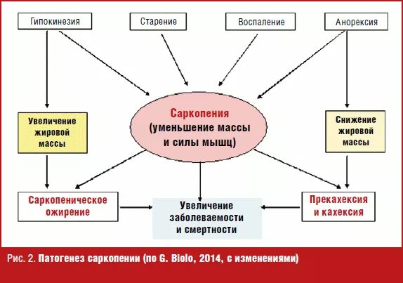 Саркопения у пожилых лечение отзывы. Саркопения патогенез. Саркопения ожирения. Саркопения механизмы развития. Диагностические критерии саркопении.