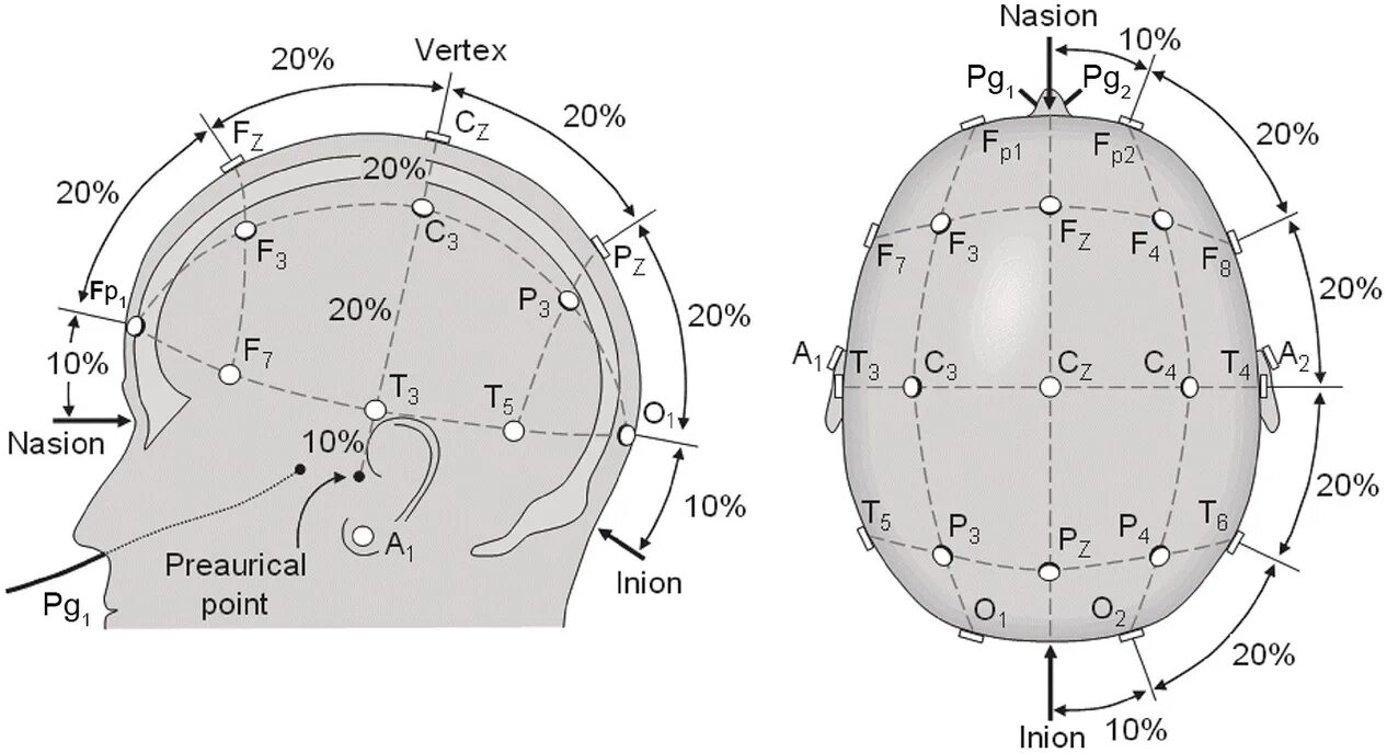 Система наложения электродов ЭЭГ 10-20. Схема расположения электродов 10-20 ЭЭГ. ЭЭГ наложение электродов схема 10-20. Схема 10-20 наложение электродов.
