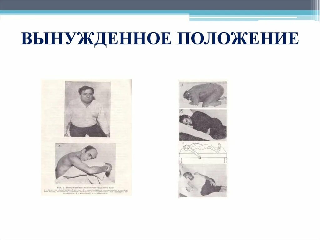 Пациент занимает вынужденное положение лежа. Вынужденное положение. вынужденное положение больного. вынужденное положение пациента при аппендиците. вынужденное положение тела.