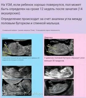 Когда по узи можно узнать пол ребенка