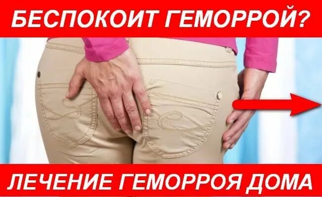 Как избавиться от геморроя без операции. От геморроя в домашних условиях. геморрой лечение в домашних условиях.