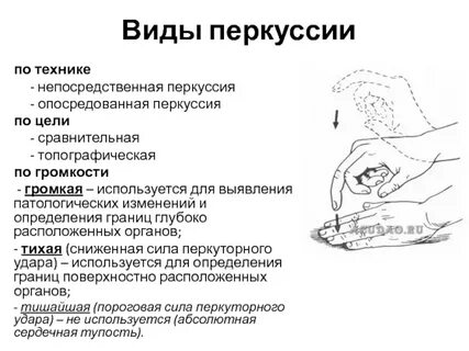 Перкуссия виды