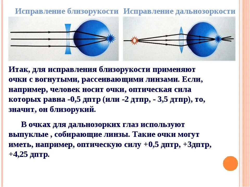 Как можно скорректировать дальнозоркость. Близорукость и дальнозоркость линзы. Для исправления близорукости применяют. Линзы для дальнозорких. Линза при дальнозорокости.