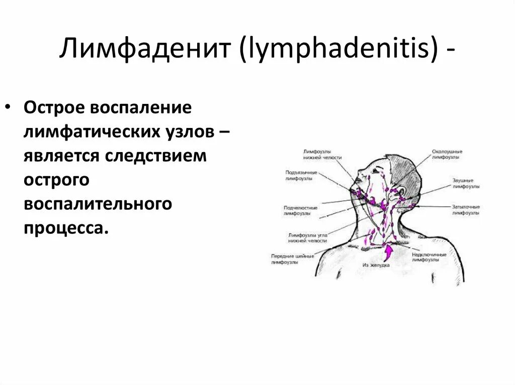 Воспаление ткани латынь. Лимфаденит это воспаление лимфатических. Лимфатические узлы шеи кт анатомия. Надключичные лимфоузлы. Регионарные лимфоузлы поднижнечелюстные шейные.