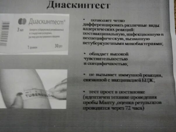 Согласие на диаскинтест образец. Согласие на диаскинтест в школе. Заявление на диаскет тест. Разрешение на диаскинтест. Отказ от диаскин теста.