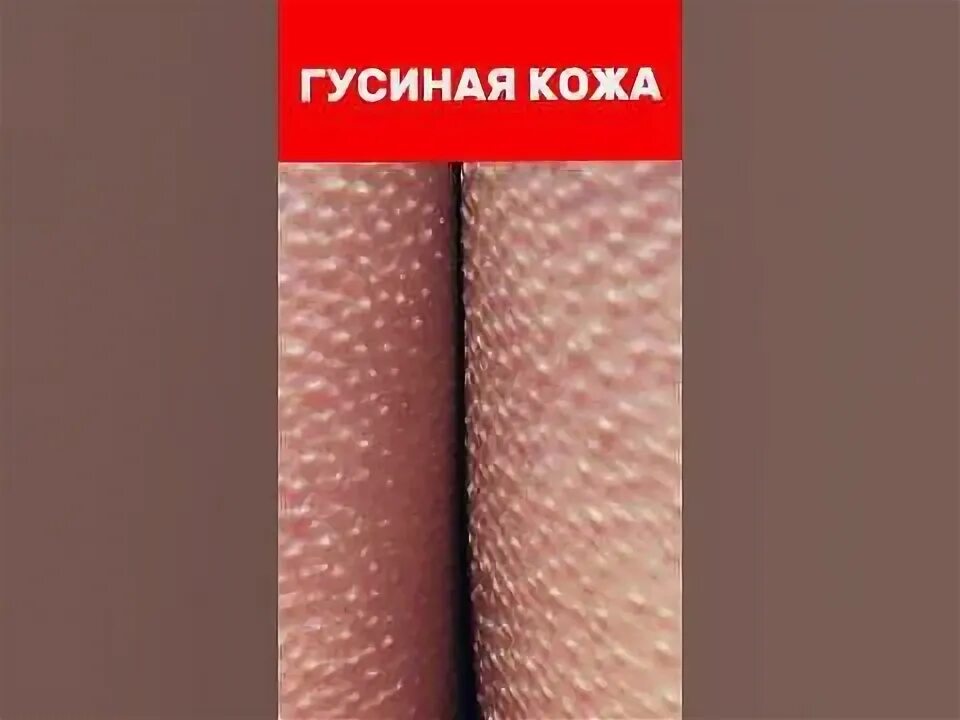 Здоровые мурашки : Включи настроение