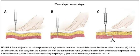 Техника инъекций z-track. Уколы вытекают почему