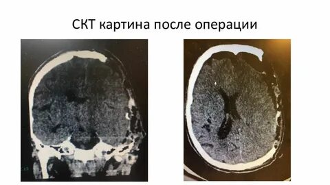 Скт старый