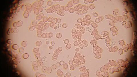 Жыныстық қатынас туралы онлайн чат