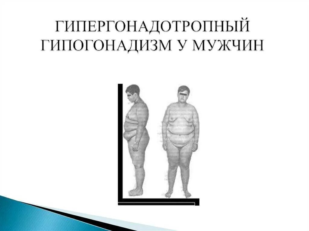 Гипогонадизм. Гипофизарный гипогонадизм. Первичный гипогонадизм у мужчин. Гипогонадизм у мужчин лечение