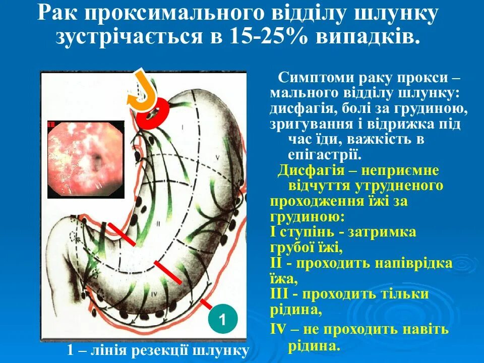 Боли в области желудка после приема