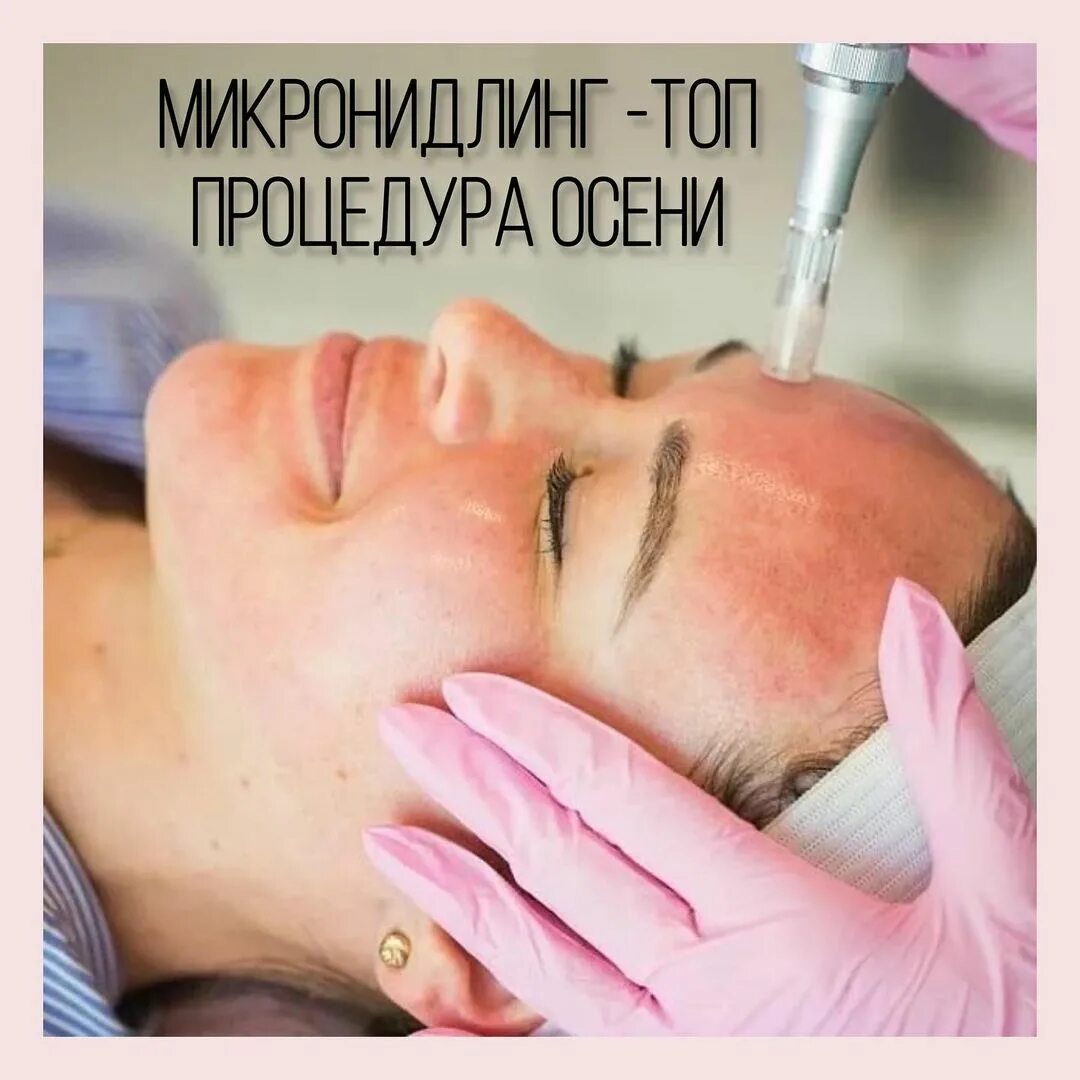 Дермапен что это такое. Микронидлинг мезотерапия. фракционная мезотерапия (микронидлинг). фракционная микроигольчатая терапия. микронидлинг дермапен.