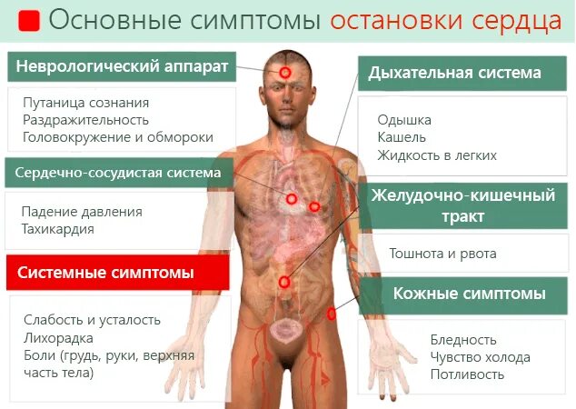 Локализация сердечной боли. Признаки боли в сердце. Боли при сердечных заболеваниях. Сердечные боли симптомы.