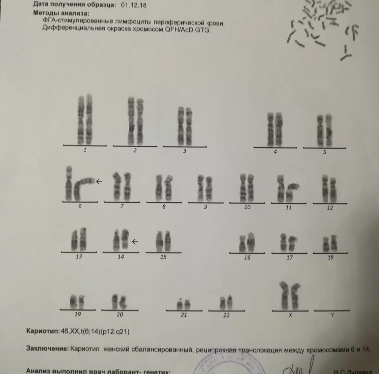 Кариотипирование супругов цена. Расшифровка кариотипа 46xy. Кариотип заключение генетика. Анализ кариотипа заключение нормальный женский кариотип. Расшифровка анализа на кариотип супругов.