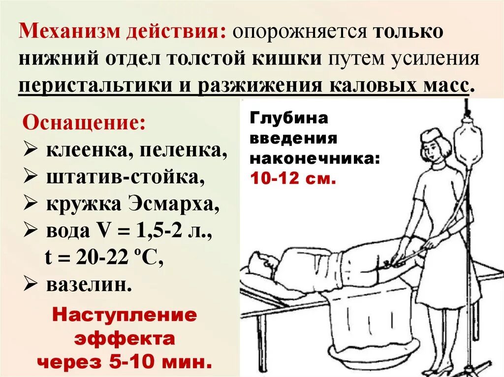 Алгоритм постановки очистительной клизмы сестринское. Механизм действия очистительной клизмы. Очистительная клизма глубина введения наконечника. Механизм действий постановки очистительной клизм. Глубина введения наконечника при постановке сифонной клизмы.