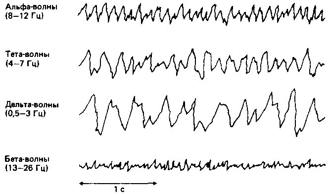 Тета и Дельта волны на ЭЭГ. Альфа тета Дельта волны. Ритмы мозга Альфа бета тета Дельта ритмы. Волны мозга Альфа бета тета. Альфа волны тета волны