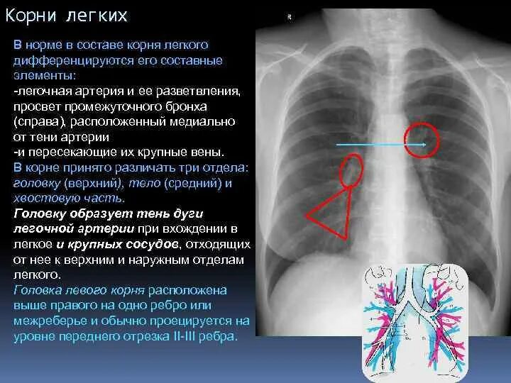 Какие легкие в норме