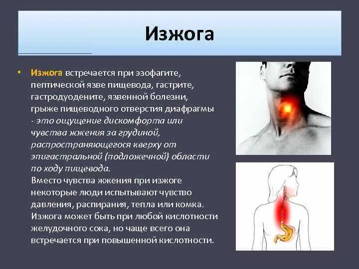 Изжога симптомы и лечение у взрослых. Симптомы изжоги желудка.