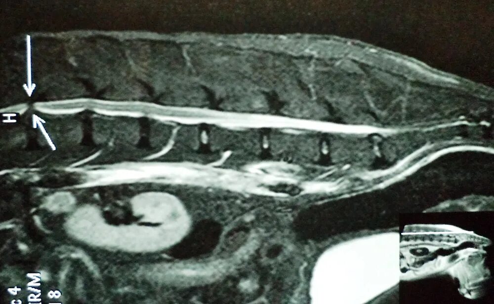 Межпозвонковая грыжа у собак. Грыжа позвоночника у собаки. Операция собаки по удалению грыжи. Дископатия у немецкой овчарки. Межпозвоночная грыжа у таксы.