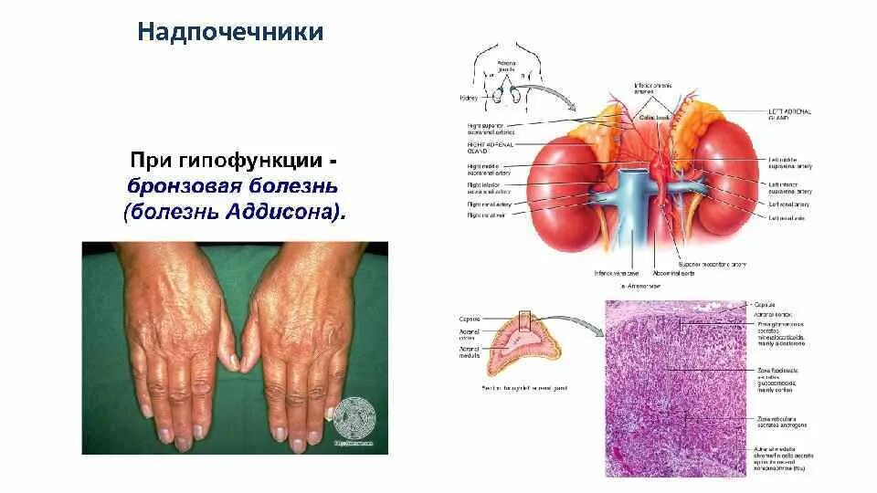 Болят ли надпочечники. Заболевания надпочечников человека. Надпочечники функции заболевания. Надпочечники расположение. Надпочечники функции и болезни.