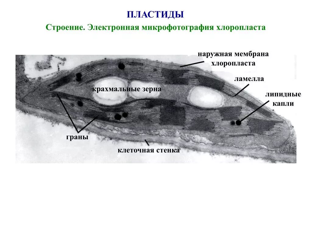 Какой органоид изображен на микрофотографии